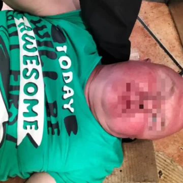 España: Detienen nuevamente al “gastrojeta”, el hombre que finge infartos para no pagar cuentas